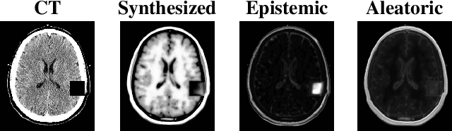 Figure 2 for Validating uncertainty in medical image translation