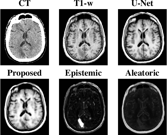 Figure 4 for Validating uncertainty in medical image translation