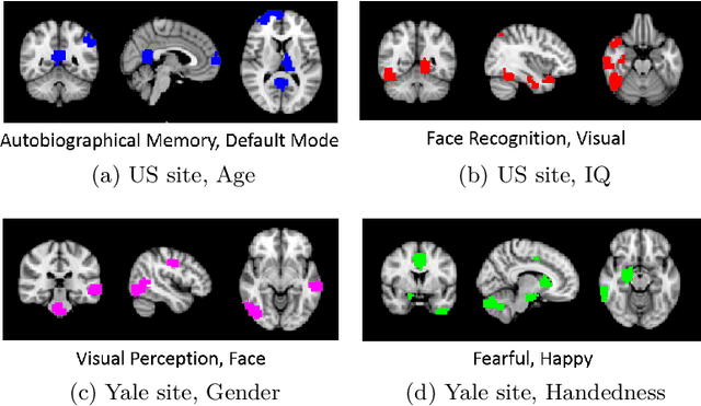 Figure 4 for Demographic-Guided Attention in Recurrent Neural Networks for Modeling Neuropathophysiological Heterogeneity