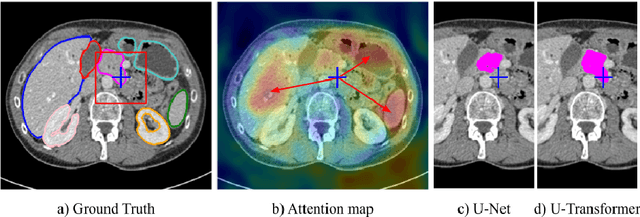 Figure 1 for U-Net Transformer: Self and Cross Attention for Medical Image Segmentation