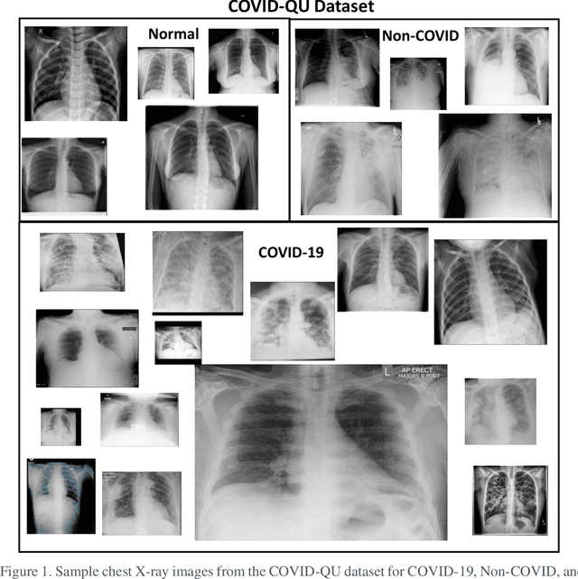 Figure 1 for COVID-19 Infection Localization and Severity Grading from Chest X-ray Images