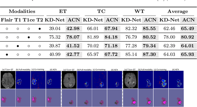 Figure 4 for ACN: Adversarial Co-training Network for Brain Tumor Segmentation with Missing Modalities
