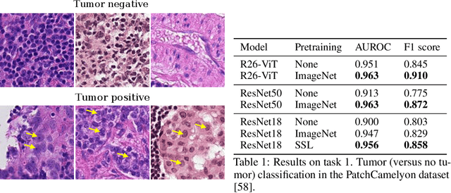 Figure 2 for Evaluating histopathology transfer learning with ChampKit