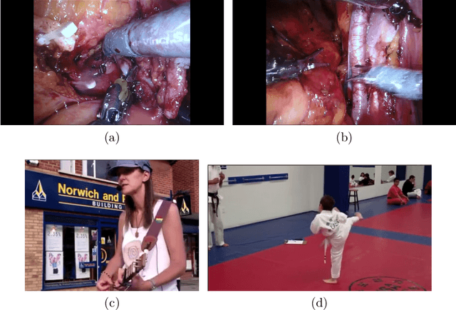 Figure 1 for ESAD: Endoscopic Surgeon Action Detection Dataset