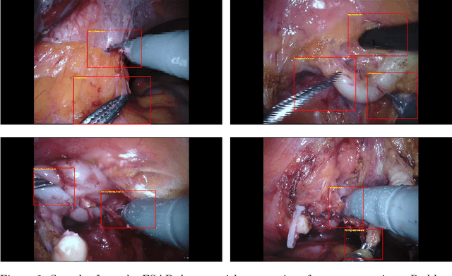 Figure 3 for ESAD: Endoscopic Surgeon Action Detection Dataset