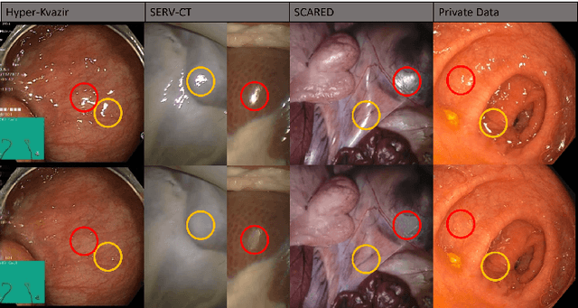 Figure 1 for A Temporal Learning Approach to Inpainting Endoscopic Specularities and Its effect on Image Correspondence