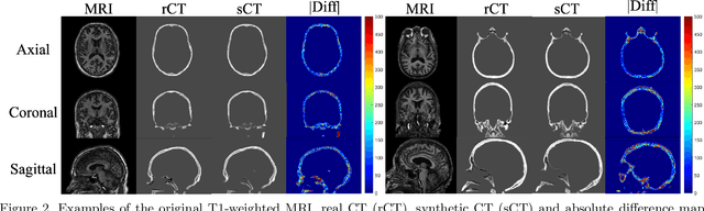 Figure 2 for Synthetic CT Skull Generation for Transcranial MR Imaging-Guided Focused Ultrasound Interventions with Conditional Adversarial Networks