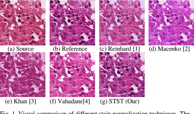 Figure 1 for Pix2Pix-based Stain-to-Stain Translation: A Solution for Robust Stain Normalization in Histopathology Images Analysis