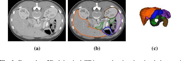 Figure 1 for Improved Abdominal Multi-Organ Segmentation via 3D Boundary-Constrained Deep Neural Networks