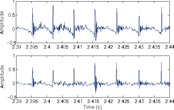 Figure 1 for Maximum Phase Modeling for Sparse Linear Prediction of Speech