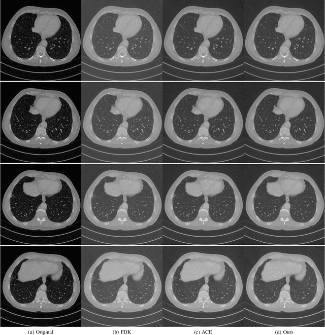 Figure 3 for A New Weighting Scheme for Fan-beam and Circle Cone-beam CT Reconstructions