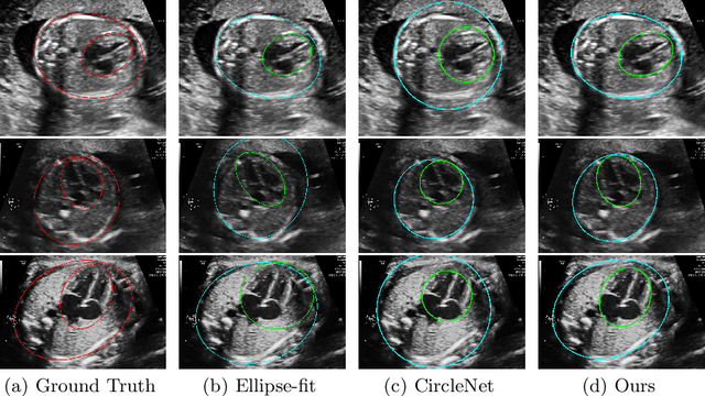 Figure 3 for EllipseNet: Anchor-Free Ellipse Detection for Automatic Cardiac Biometrics in Fetal Echocardiography