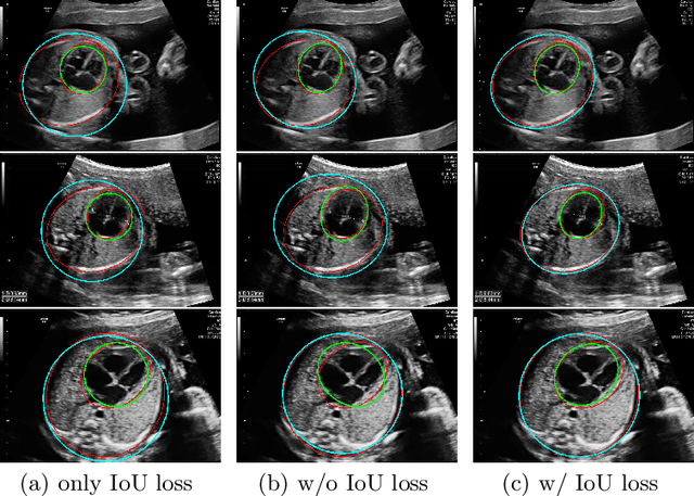 Figure 4 for EllipseNet: Anchor-Free Ellipse Detection for Automatic Cardiac Biometrics in Fetal Echocardiography