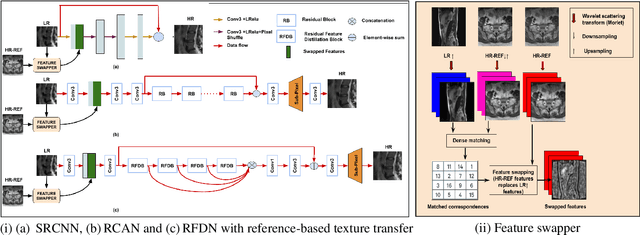 Figure 3 for Reference-based Texture transfer for Single Image Super-resolution of Magnetic Resonance images