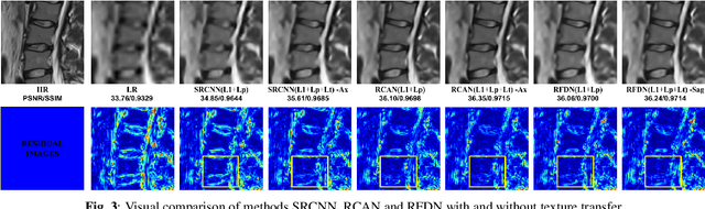 Figure 4 for Reference-based Texture transfer for Single Image Super-resolution of Magnetic Resonance images