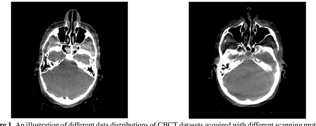 Figure 1 for Generalizability issues with deep learning models in medicine and their potential solutions: illustrated with Cone-Beam Computed Tomography (CBCT) to Computed Tomography (CT) image conversion