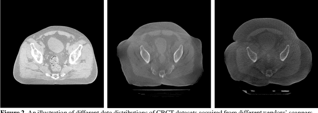 Figure 3 for Generalizability issues with deep learning models in medicine and their potential solutions: illustrated with Cone-Beam Computed Tomography (CBCT) to Computed Tomography (CT) image conversion