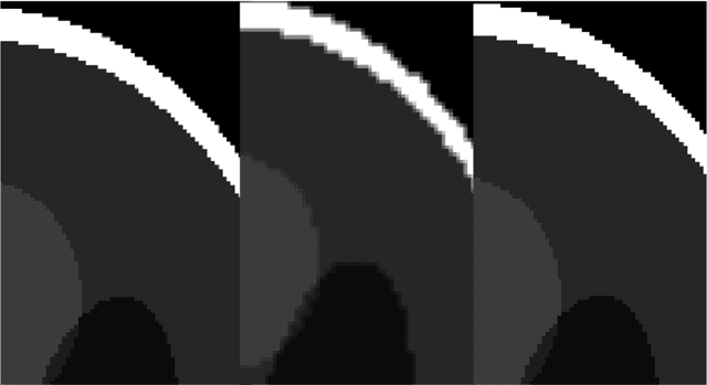 Figure 4 for Reducing the Gibbs effect in multimodal medical imaging by the Fake Nodes Approach