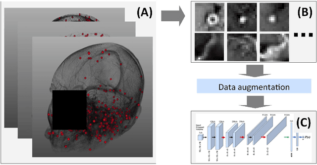 Figure 3 for Augmented Networks for Faster Brain Metastases Detection in T1-Weighted Contrast-Enhanced 3D MRI