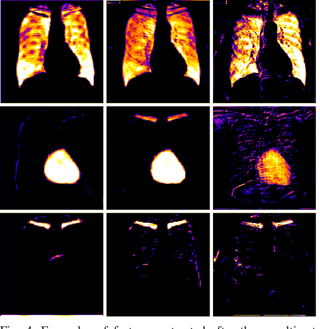 Figure 4 for Fully Convolutional Architectures for Multi-Class Segmentation in Chest Radiographs
