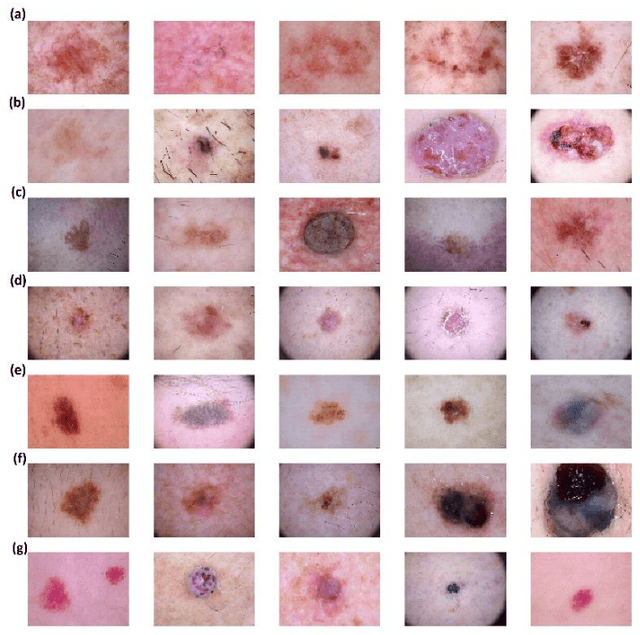 Figure 1 for Skin Lesion Analyser: An Efficient Seven-Way Multi-Class Skin Cancer Classification Using MobileNet