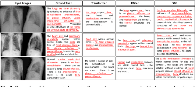 Figure 4 for A Self-Guided Framework for Radiology Report Generation