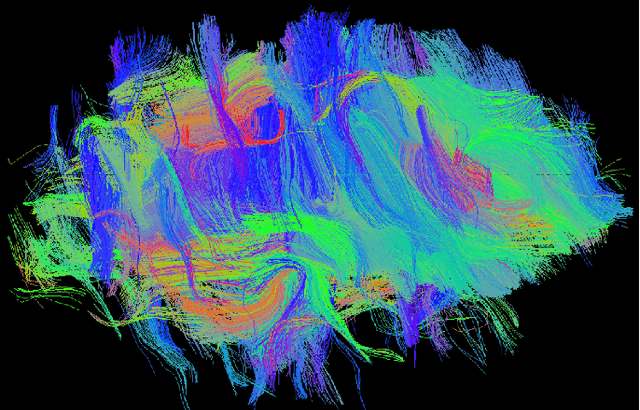 Figure 4 for ShuffleUNet: Super resolution of diffusion-weighted MRIs using deep learning