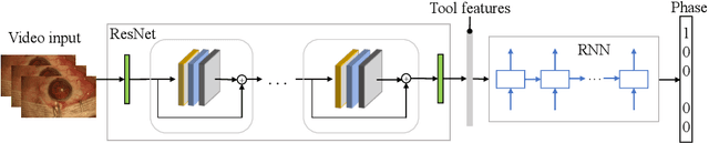 Figure 3 for DeepPhase: Surgical Phase Recognition in CATARACTS Videos