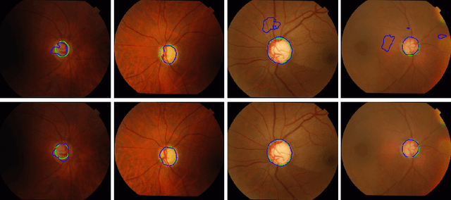 Figure 3 for Residual Moment Loss for Medical Image Segmentation