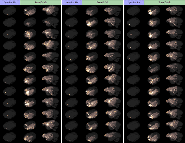 Figure 3 for MarmoNet: a pipeline for automated projection mapping of the common marmoset brain from whole-brain serial two-photon tomography