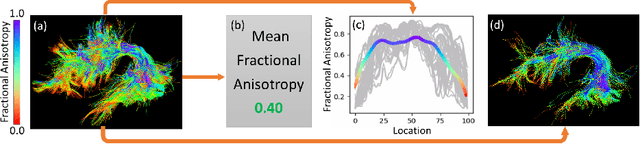 Figure 1 for White Matter Tracts are Point Clouds: Neuropsychological Score Prediction and Critical Region Localization via Geometric Deep Learning