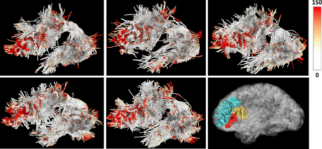 Figure 4 for White Matter Tracts are Point Clouds: Neuropsychological Score Prediction and Critical Region Localization via Geometric Deep Learning