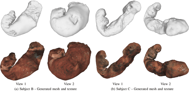 Figure 3 for 3D Reconstruction of Whole Stomach from Endoscope Video Using Structure-from-Motion
