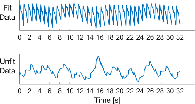 Figure 4 for A Novel Non-Invasive Estimation of Respiration Rate from Photoplethysmograph Signal Using Machine Learning Model