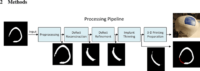 Figure 1 for Deep Learning-based Framework for Automatic Cranial Defect Reconstruction and Implant Modeling