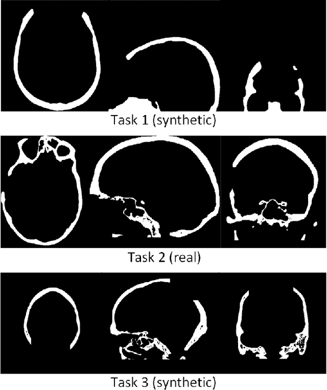 Figure 3 for Deep Learning-based Framework for Automatic Cranial Defect Reconstruction and Implant Modeling