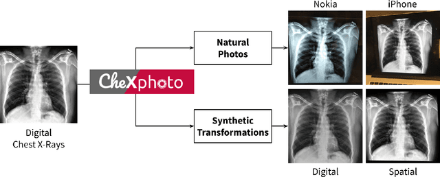 Figure 1 for CheXphoto: 10,000+ Smartphone Photos and Synthetic Photographic Transformations of Chest X-rays for Benchmarking Deep Learning Robustness