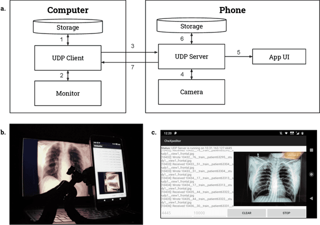 Figure 3 for CheXphoto: 10,000+ Smartphone Photos and Synthetic Photographic Transformations of Chest X-rays for Benchmarking Deep Learning Robustness