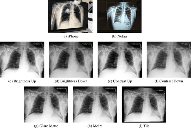 Figure 4 for CheXphoto: 10,000+ Smartphone Photos and Synthetic Photographic Transformations of Chest X-rays for Benchmarking Deep Learning Robustness
