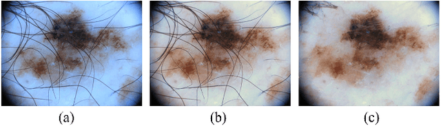 Figure 3 for Supervised Saliency Map Driven Segmentation of the Lesions in Dermoscopic Images