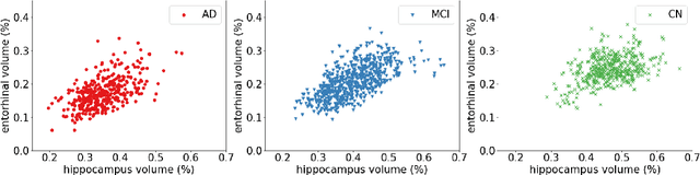 Figure 2 for On the design of convolutional neural networks for automatic detection of Alzheimer's disease