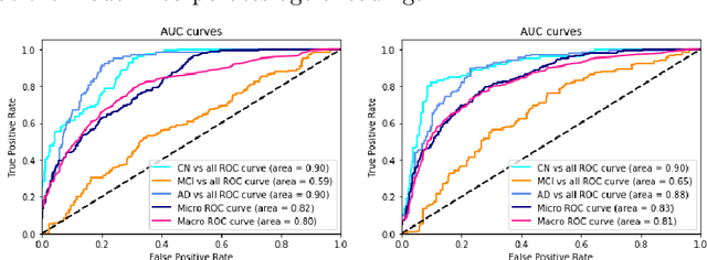 Figure 4 for On the design of convolutional neural networks for automatic detection of Alzheimer's disease