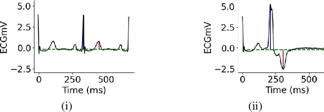 Figure 3 for Weak Supervision for Affordable Modeling of Electrocardiogram Data