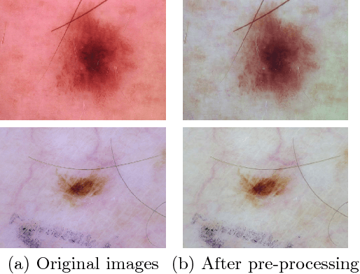 Figure 1 for Multi-Class Lesion Diagnosis with Pixel-wise Classification Network