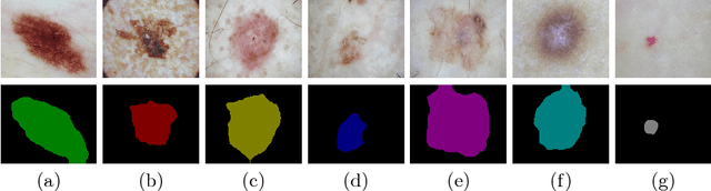 Figure 3 for Multi-Class Lesion Diagnosis with Pixel-wise Classification Network