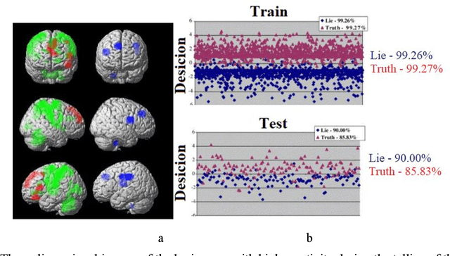 Figure 1 for Progress in neural networks for EEG signal recognition in 2021