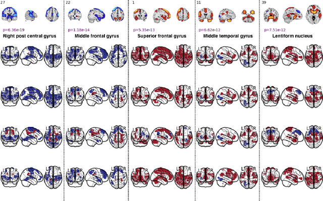 Figure 1 for Spatio-temporal Dynamics of Intrinsic Networks in Functional Magnetic Imaging Data Using Recurrent Neural Networks