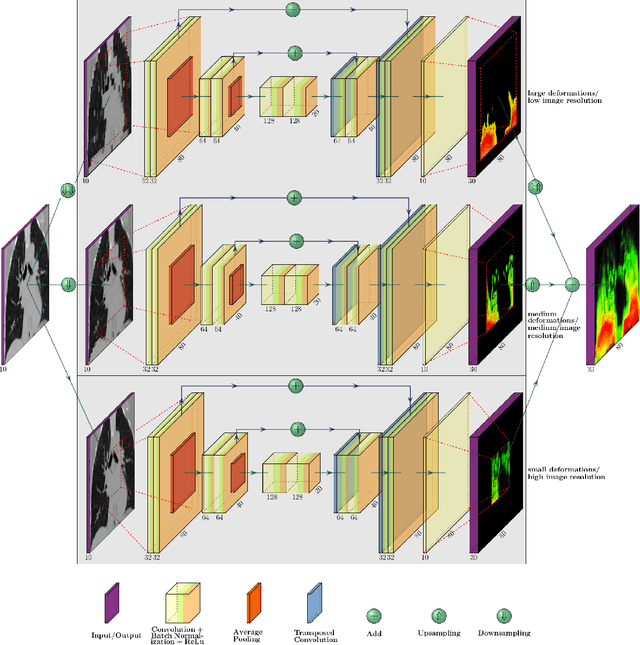 Figure 1 for One Shot Learning for Deformable Medical Image Registration and Periodic Motion Tracking