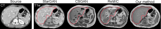 Figure 1 for TarGAN: Target-Aware Generative Adversarial Networks for Multi-modality Medical Image Translation