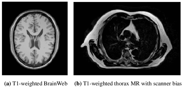 Figure 1 for Sinusoidal Sensitivity Calculation for Line Segment Geometries
